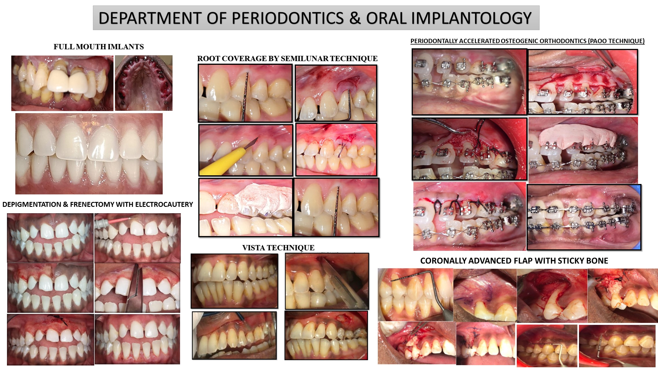 Periodontics